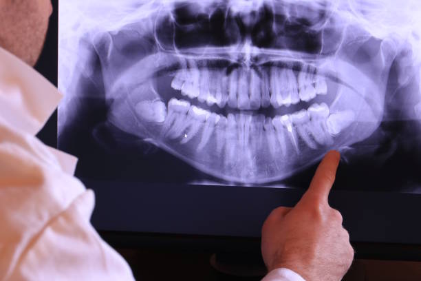 Best Emergency Broken Tooth Repair in Rutgers University Busch Campus, NJ