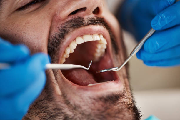 Best Emergency Tooth Extraction in Rutgers University Busch Campus, NJ